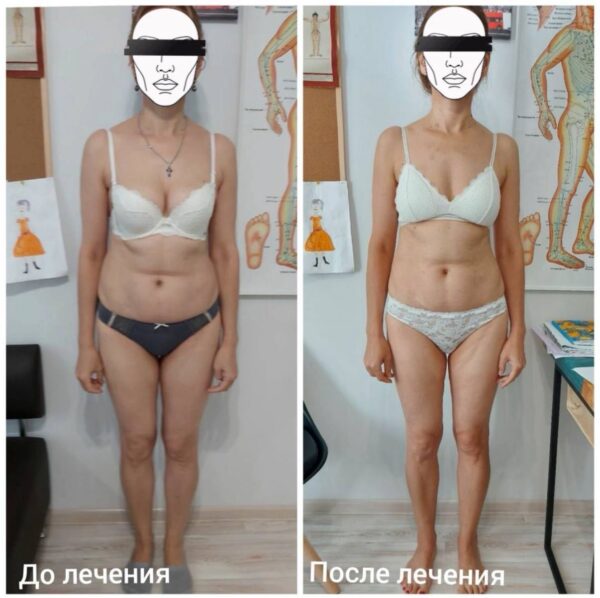 Глобальна соматична корекція Робота: Поєднання технік краніальної терапії з остеопатичною роботою по всьому тілу. Цілісний підхід дозволяє усунути першопричину дисфункції, а не лише її локальні прояви.