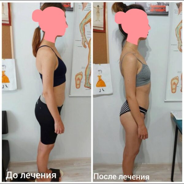 Глобальна соматична корекція Робота: Поєднання технік краніальної терапії з остеопатичною роботою по всьому тілу. Цілісний підхід дозволяє усунути першопричину дисфункції, а не лише її локальні прояви.